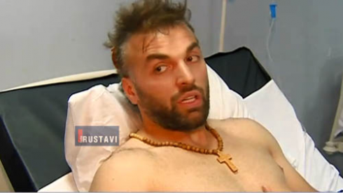 ჩცდ-ს მსახიობს თავს დაესხნენ (ვიდეო)