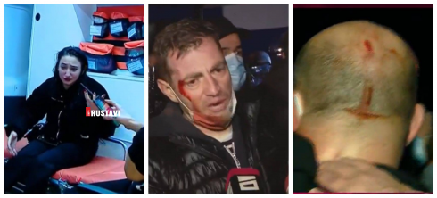 8 ნოემბერს ცესკოს-თან 27 პირი დაშავდა