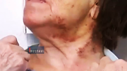 85 წლის ქალი აწამეს და გაძარცვეს (ვიდეო)