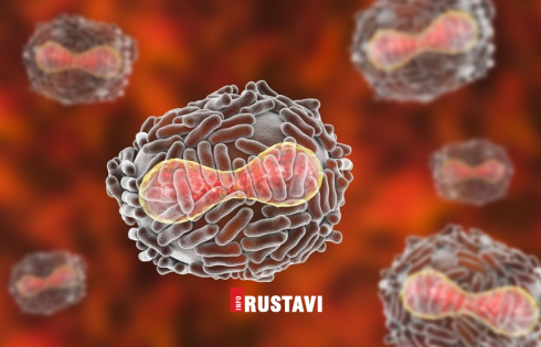 შესწავლილია "მაიმუნის ყვავილის" 7 საეჭვო შემთხვევა