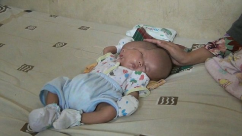 ორსახიანი ბავშვი დაიბადა [video]