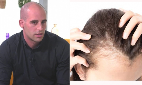 "თმის ცვენის საწინააღმდეგო შამპუნი არ არსებობს"