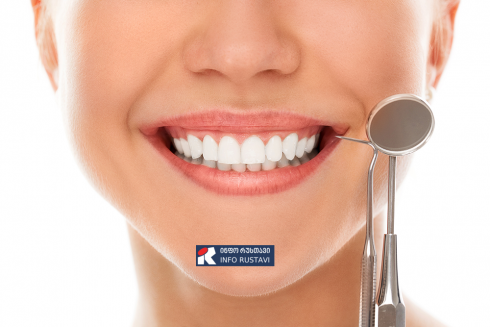 როგორ გავილამაზოთ ღიმილი სტომატოლოგიური ვინირების საშუალებით