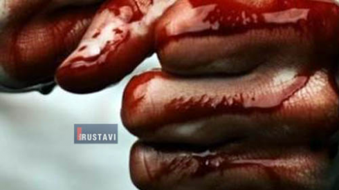 "მანქანიდან ჩამოიყვანეს და უმოწყალოდ სცემეს" (ვიდეო)