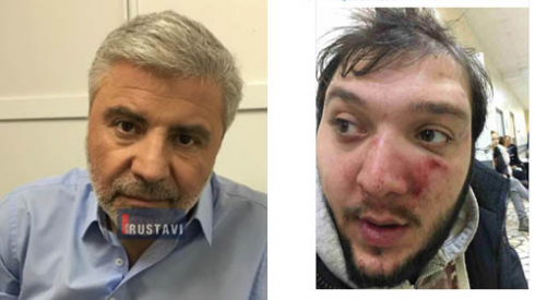 გიორგი გაბედავას თავს დაესხნენ