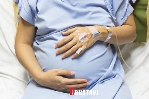 კოვიდ 19-ით 25 ორსული დაიღუპა