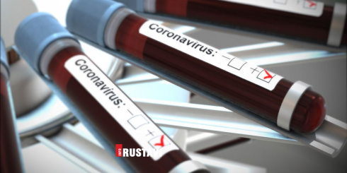 კორონავირუსი საქართველოს მე-4 მოქალაქეს დაუდგინდა